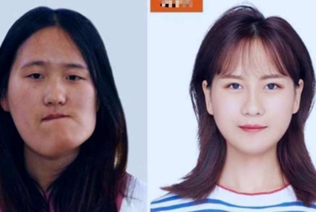 歪脸女孩不料整容成功丑小鸭瞬间变天鹅为啥还回大山当教师