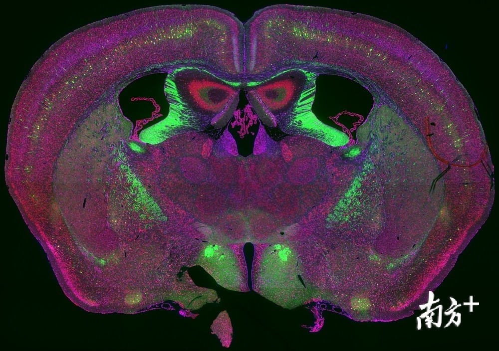 破译大脑运转密码,深圳先进院完成世界首幅猴脑全脑图谱
