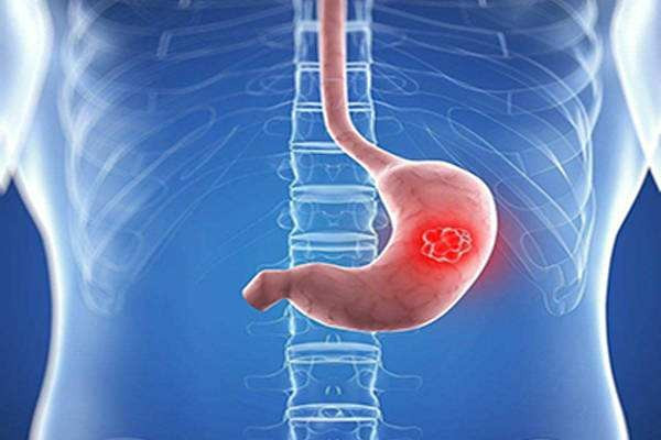 德胜门医生牛小培主任:胃癌早期症状知多少?_腾讯新闻