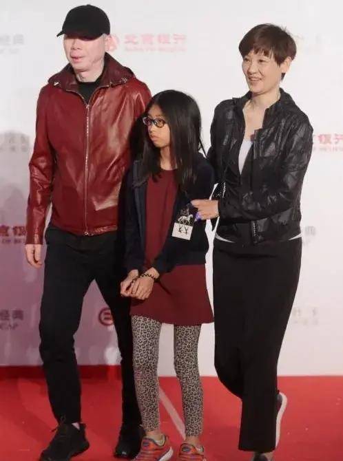 冯小刚近照曝光白癜风明显,头部疑似起大包,皮肤比女演员还白