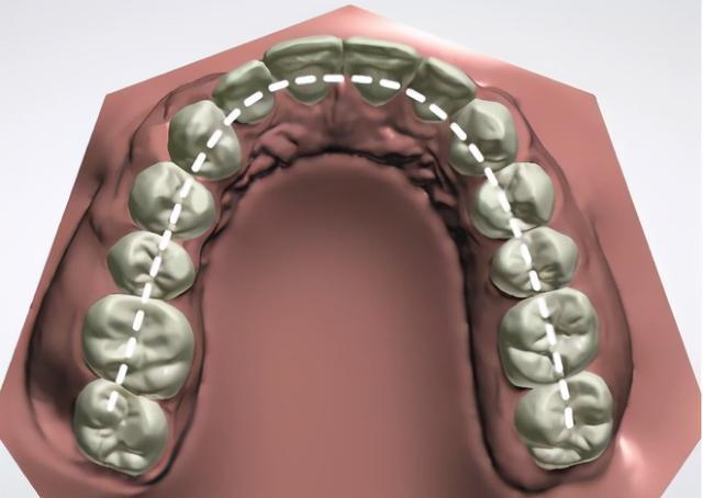 位于上颌的叫上牙弓,位于下颌就叫下牙弓.