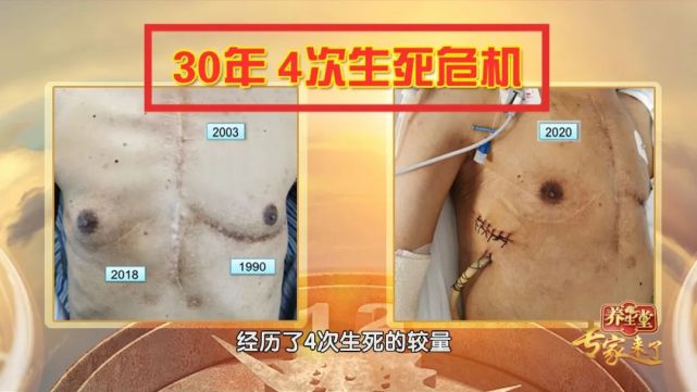 这一年患者只有19岁 19岁-49岁,人生最好的30年,被致命的心脏病所