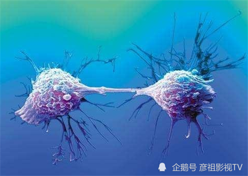 史上唯一拥有不死细胞的人 一生救了数十亿人 亲人对此恨骂不绝 海拉细胞 细胞 癌症 乔治 盖 海里埃塔 拉克丝 癌细胞