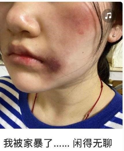 "我被家暴了……闲得无聊"它不再是痛苦,阴暗的代名词,满脸伤痕,神情