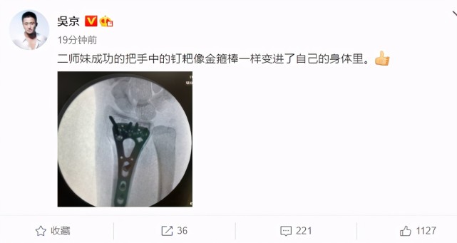 妻子谢楠手术成功 吴京晒桡骨钢钉照骂其是猪 并忙于筹拍新电影 腾讯网