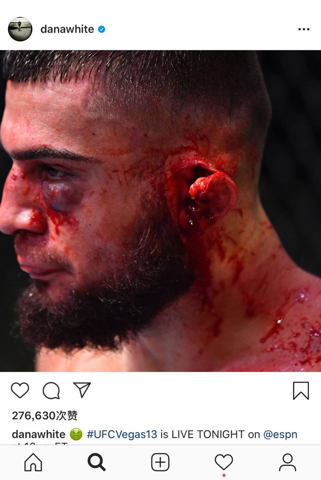 慎入这是最凶残的肘击耳朵被撕掉一半