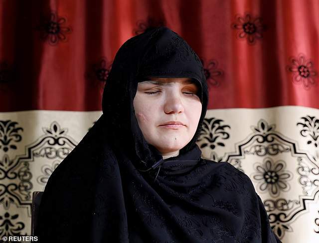 阿富汗女子出外工作,父亲反对并向塔利班举报,女子遭枪击双眼被刺瞎