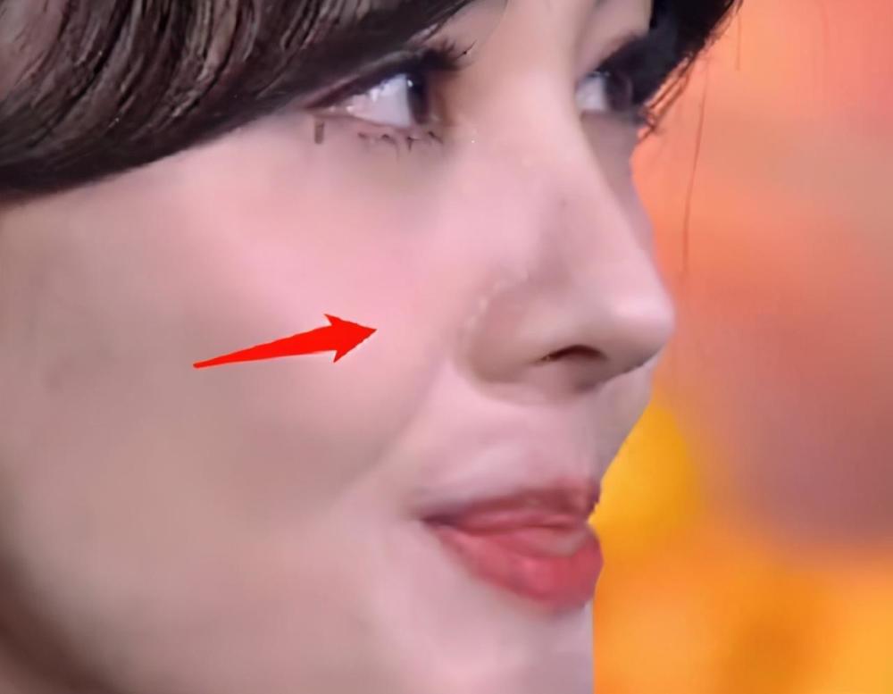 郑爽整容风波不断网友热议疑似出现整容后遗症难道爱美也是错