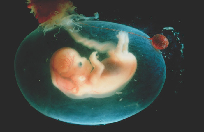 并排出婴儿肺部的液体 这包括从胎盘中渗出的水,但是当 羊水过高时,这