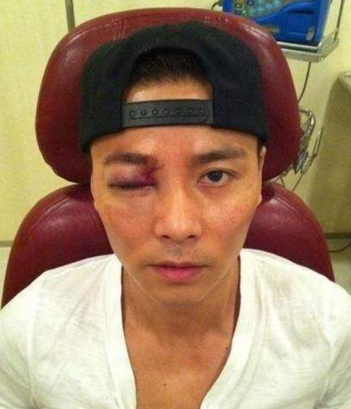 明星受伤惹争议,谢楠骨折,吴京被传"打老婆",于朦胧超敬业