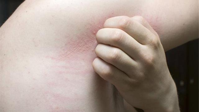 身体出现4个异常,有可能是血糖升高的信号,请及时注意,别错过