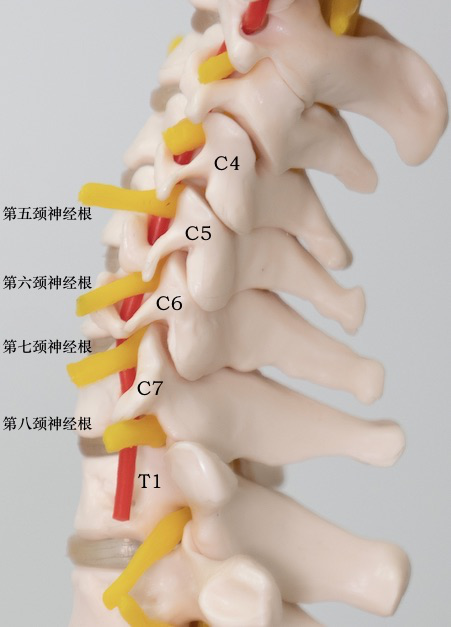 定义:各种原因致使颈椎管内或椎间孔内的神经根受到刺激,压迫所致.