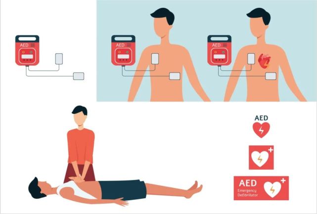 aed操作示意图 图源:站酷海洛其实,aed 跟傻瓜相机类似.