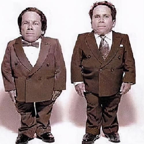 奥地利一男子患上侏儒症之后,又同时得巨人症|侏儒症|亚当·让纳|巨人