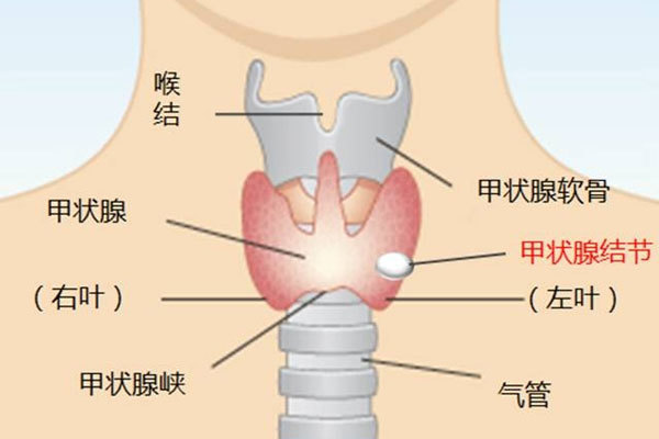 什么是"甲状腺结节"?如何才能有效避免结节"病变"?专家黄国常为你解密