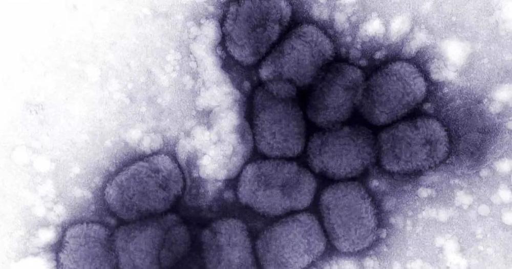 天花病毒|人类至今储存着天花病毒，世卫组织建议销毁无果，是否销毁成争议