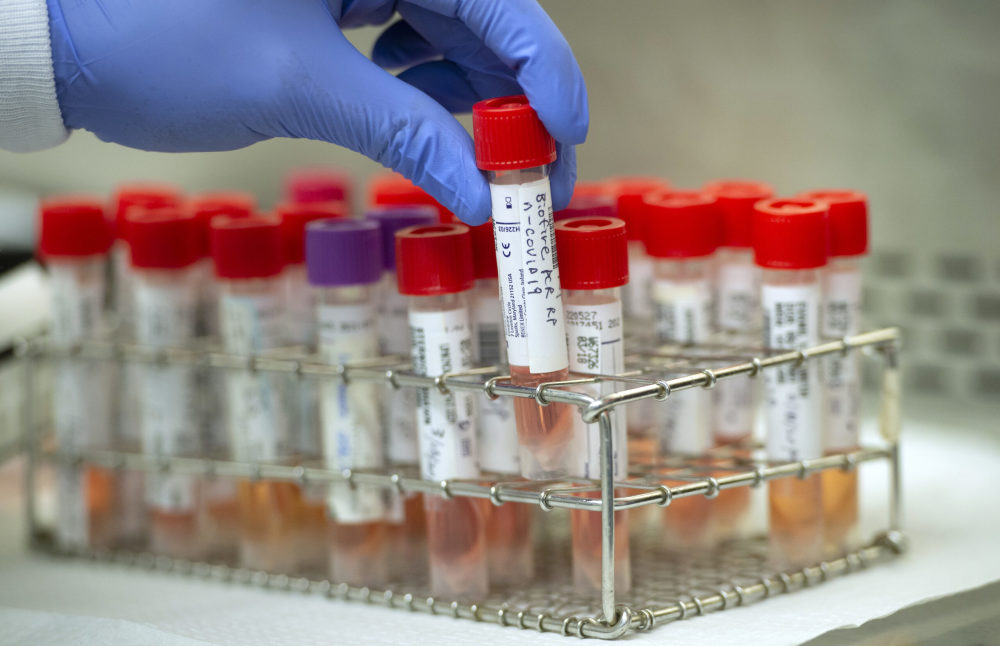 新冠病毒|美国实验室新冠病毒检测能力告急，等待时间将再延长