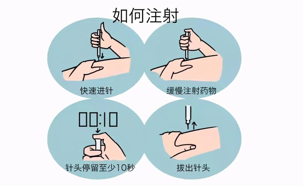 糖友们如何避开误区正确注射胰岛素这份小贴士值得您收藏