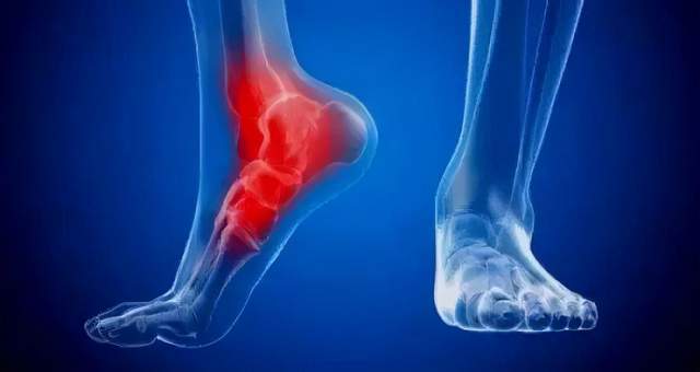 40岁后容易出现足跟痛多是这3种原因造成的早点知道比较好