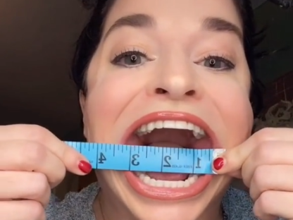 世界最大嘴巴30岁女嘴长10公分爆红拍一支抖音赚1万5美元