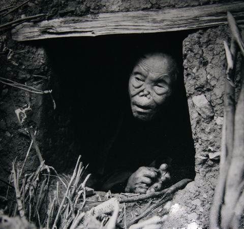 老照片:恐怖的麻风病人?