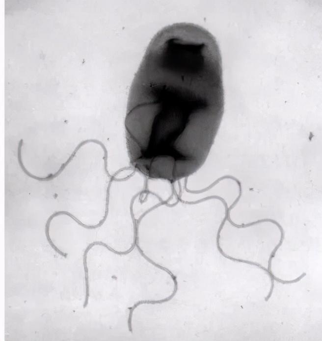 巴尔通体的电镜照片汉赛巴通体存在于猫的口咽部,跳蚤是猫群的传播