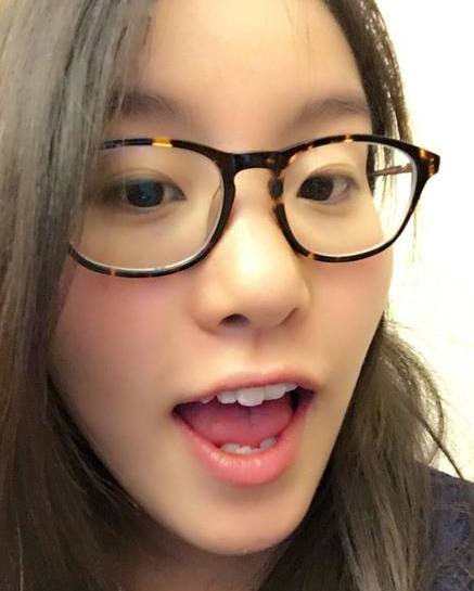 "洪荒少女"傅园慧整牙成功,颜值大提升,不输女明星