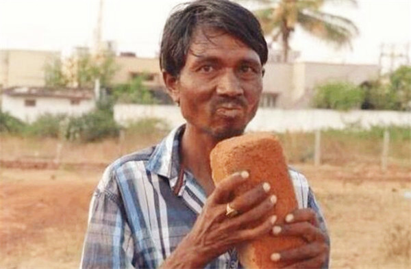 |一男子不吃饭菜只吃“砖头”，连续吃20年，砖头都能盖一栋别墅