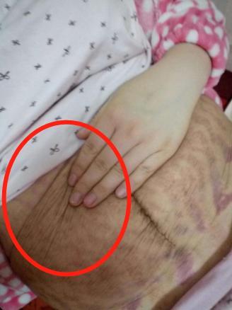 宝妈剖腹生下宝宝,当丈夫看到妻子的肚子后:"噗通"跪在地上!