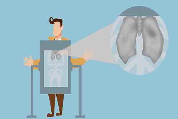 钟南山院士|同样是活了80多岁，钟南山为何这样看待抽烟者？他是这样说的