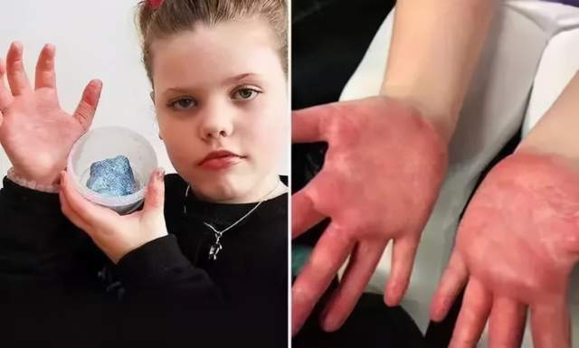 上海|福建3岁女孩被玩具直插颅脑！这些玩具危险重重，你家至少有一样！