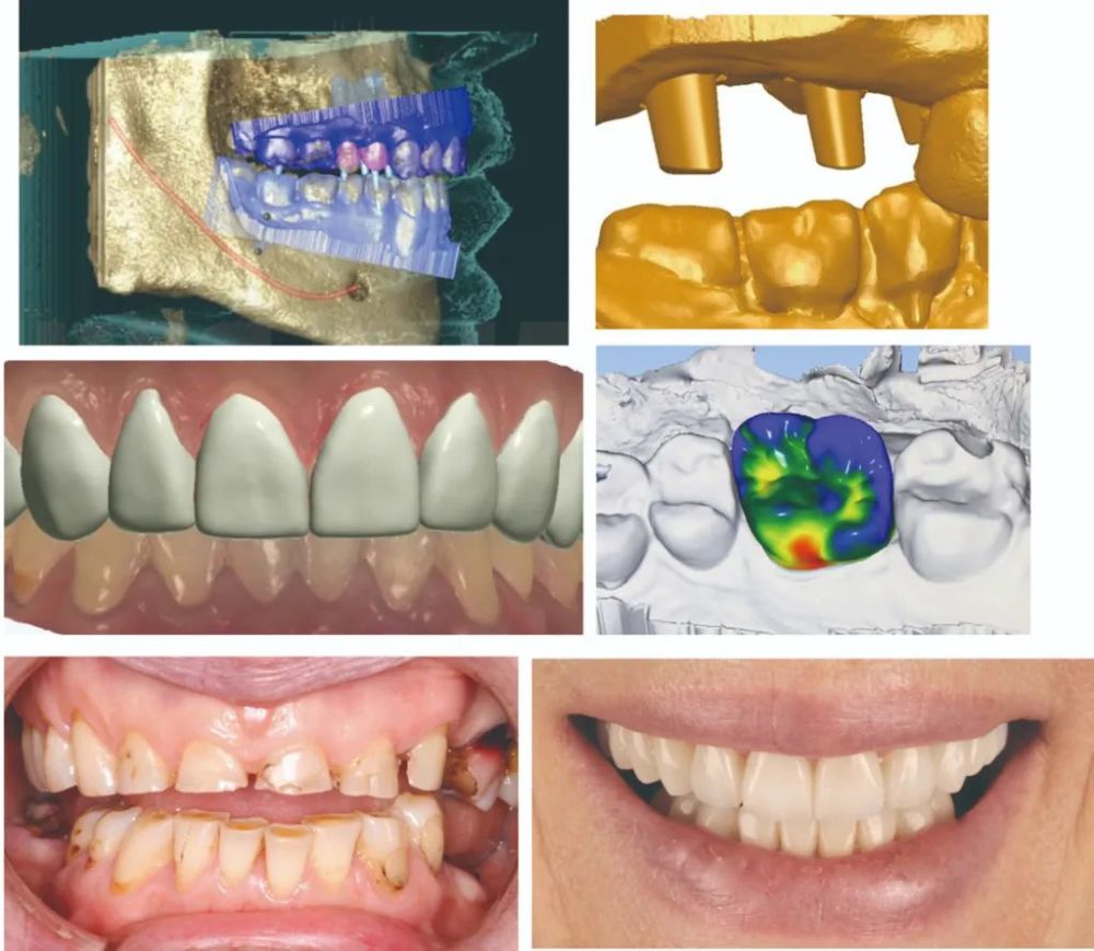 牙釉质|相比手相大师，“牙相”大师能知道更多秘密？一颗牙阅读你的一生