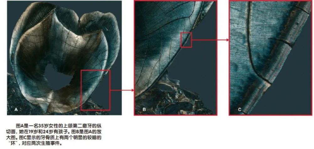 牙釉质|相比手相大师，“牙相”大师能知道更多秘密？一颗牙阅读你的一生