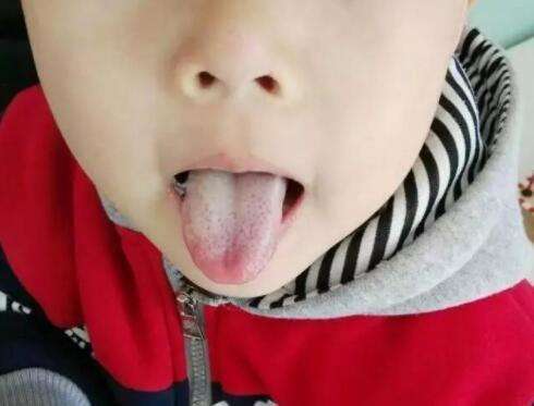 小孩积食嘴巴酸臭,坚持做两件事,消食化积,个头蹭蹭涨_腾讯新闻