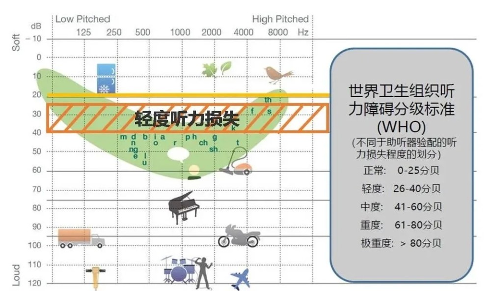 轻度听力损失 用不用配助听器 腾讯新闻