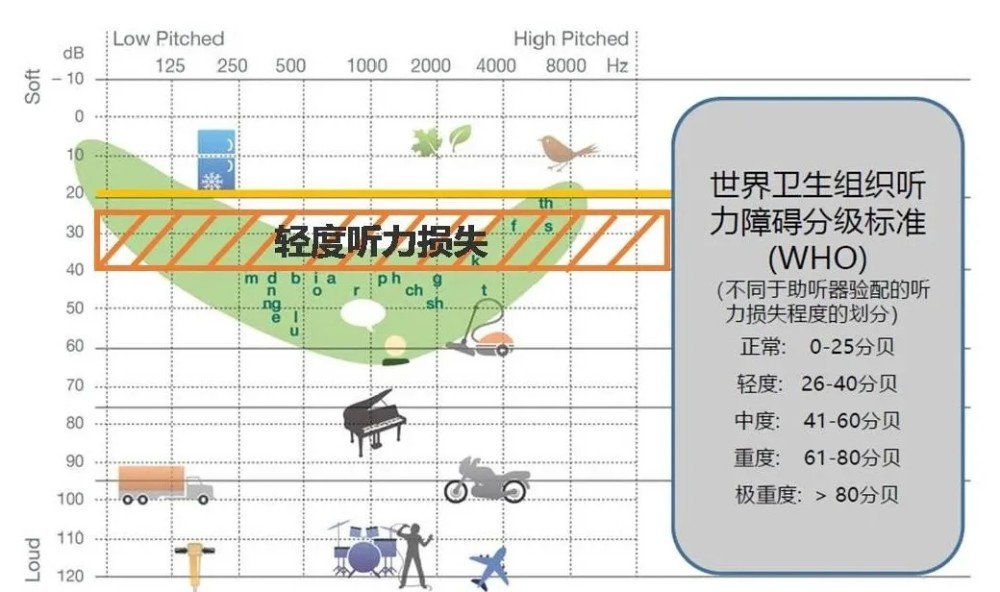 轻度听力损失 用不用配助听器 腾讯新闻