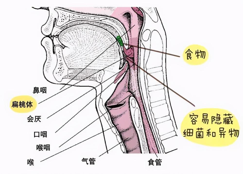 会厌溪解剖图片