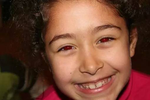 科普瞳孔下隐藏的秘密那些你不知道的瞳言瞳语