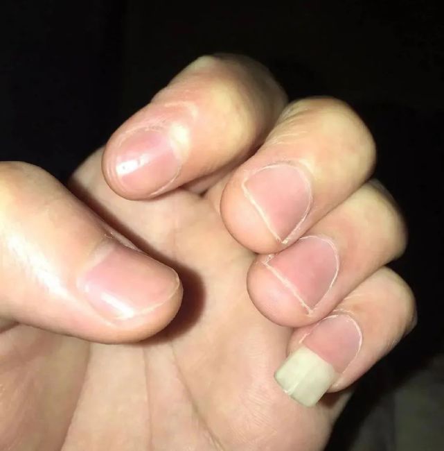 一个疑问爱留小指姆指甲的男人到底是怎么想的啊