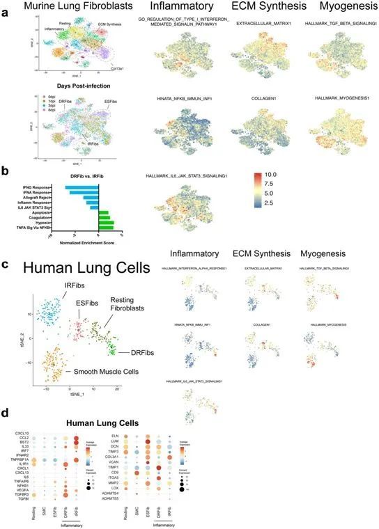 肺部|《自然》：揭示过度的成纤维细胞激活通过ADAMTS4损害肺部功能