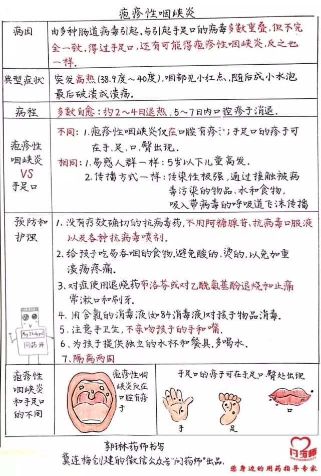疱疹性咽峡炎高发一图读懂这个疾病的治疗和护理方法
