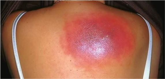 人体真的会那么脆弱吗!_腾讯新闻