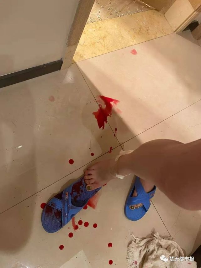 "女友受惊后退一步,脚被地上玻璃碎片扎伤血流不止,左手中指也被地上