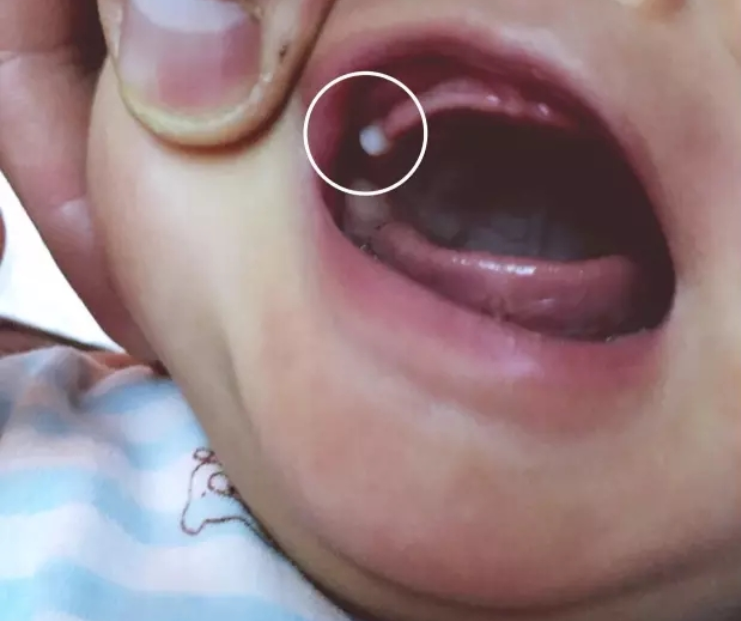 新生宝宝长出牙齿是妈妈喂养得好还是天赋异禀结果打脸