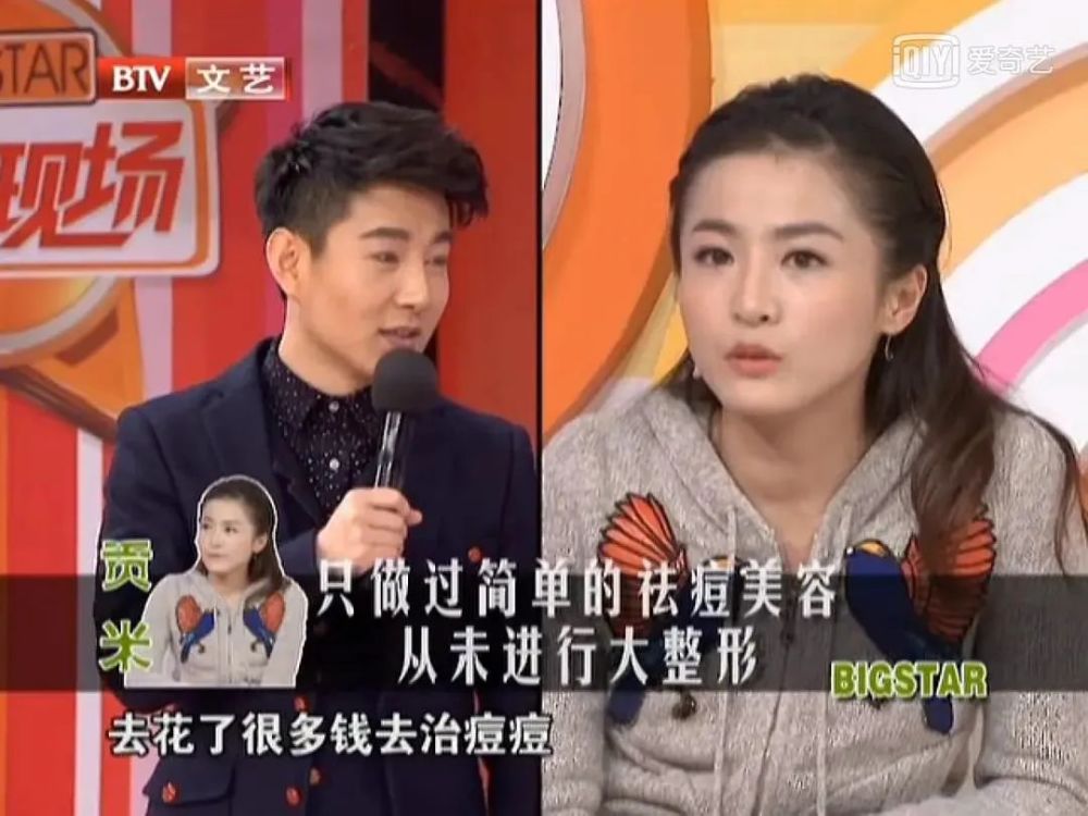 张柏芝|她的脸变化可真大……