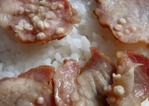 猪肉有淋巴结,就是甲亢