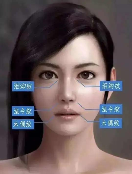 打开腾讯新闻,查看更多图片 >什么是三八线:泪沟,鼻唇沟,木偶纹,这三