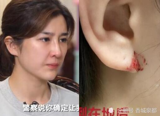 张培萌妻子谈产后第17天被家暴:"我要真想打你,我打死你"