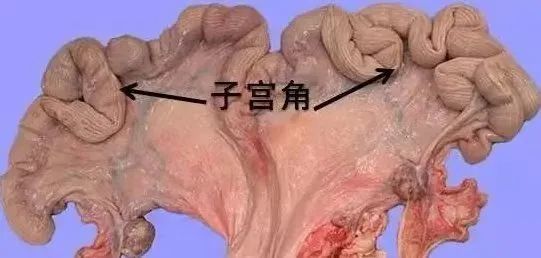 常艾灸清理子宫很多妇科方面的烦恼都能避免子宫不排毒便成垃圾场