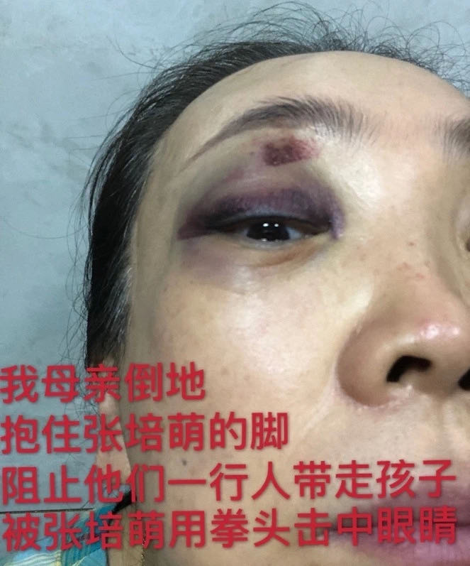 世界冠军家暴妻子运动员都这样雄性激素高